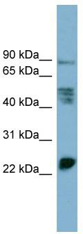 MPZL (MPZL1) Rabbit Polyclonal Antibody