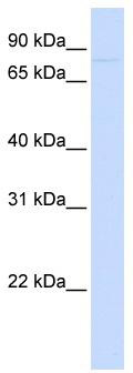 WB Suggested Anti-CDH12 Antibody Titration: 0.2-1 ug/ml; ELISA Titer: 1: 312500; Positive Control: 721_B cell lysate.CDH12 is supported by BioGPS gene expression data to be expressed in 721_B