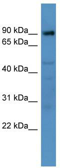 WB Suggested Anti-Adam22 Antibody Titration: 0.2-1 ug/ml; ELISA Titer: 1: 312500; Positive Control: Mouse Liver