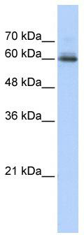 WB Suggested Anti-SEMA4F Antibody Titration: 0.2-1 ug/ml; ELISA Titer: 1: 1562500; Positive Control: Transfected 293T