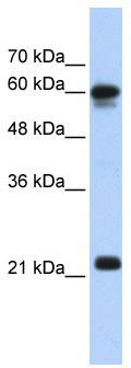 WB Suggested Anti-SEMA4F Antibody Titration: 0.2-1 ug/ml; ELISA Titer: 1: 312500; Positive Control: Transfected 293T