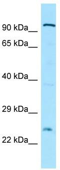 WB Suggested Anti-Cdh7 Antibody; Titration: 1.0 ug/ml; Positive Control: Rat Heart