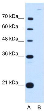 WB Suggested Anti-CDH7 Antibody Titration: 0.2-1 ug/ml; Positive Control: HepG2 cell lysate
