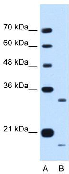 WB Suggested Anti-CCPG1 Antibody Titration: 0.2-1 ug/ml; Positive Control: HepG2 cell lysate