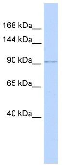 WB Suggested Anti-NDST3 Antibody Titration: 0.2-1 ug/ml; ELISA Titer: 1: 1562500; Positive Control: Hela cell lysate