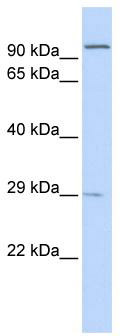 WB Suggested Anti-SSPN Antibody Titration: 0.2-1ug/mL; Positive control: 721_B cell lysate.