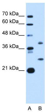 WB Suggested Anti-ST8SIA2 Antibody Titration: 1 ug/ml; Positive Control: HepG2 cell lysate