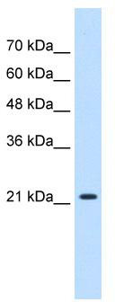 WB Suggested Anti-PGRMC1 Antibody Titration: 0.2-1 ug/ml; Positive Control: HepG2 cell lysate