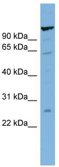 WB Suggested Anti-C6orf10 Antibody Titration: 0.2-1 ug/ml; Positive Control: ACHN cell lysate