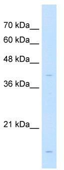WB Suggested Anti-LMAN2 Antibody Titration: 1 ug/ml; Positive Control: Jurkat cell lysate