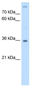 WB Suggested Anti-LMAN2 Antibody Titration: 0.2-1 ug/ml; Positive Control: Jurkat cell lysate
