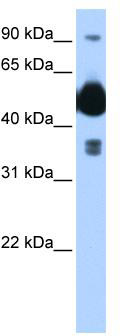 WB Suggested Anti-FICD Antibody Titration: 0.2-1 ug/ml; Positive Control: Transfected 293T