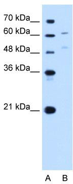 WB Suggested Anti-UGT1A4 Antibody Titration: 0.2-1 ug/ml; Positive Control: HepG2 cell lysate