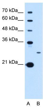 WB Suggested Anti-TSPAN15 Antibody Titration: 0.2-1 ug/ml; Positive Control: HepG2 cell lysate