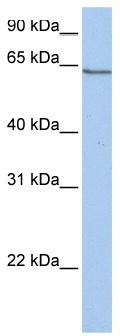 WB Suggested Anti-PCDHA4 Antibody Titration: 0.2-1 ug/ml; Positive Control: Hela cell lysate