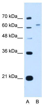WB Suggested Anti-WSCD2 Antibody Titration: 1.25 ug/ml; Positive Control: HepG2 cell lysate