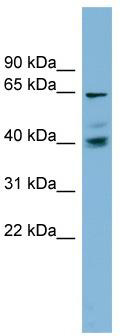 WB Suggested Anti-TM9SF4 Antibody Titration: 0.2-1 ug/ml; ELISA Titer: 1: 1562500; Positive Control: NCI-H226 cell lysate