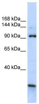 WB Suggested Anti-KIAA1024 Antibody Titration: 0.2-1 ug/ml; ELISA Titer: 1: 312500; Positive Control: Human brain