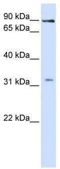 WB Suggested Anti-LRRC8B Antibody Titration: 1 ug/ml; Positive Control: Fetal liver cell lysate