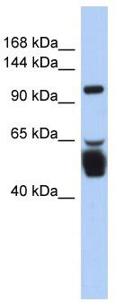 WB Suggested Anti-LRRC8B Antibody Titration: 0.2-1 ug/ml; ELISA Titer: 1: 62500; Positive Control: Human Stomach