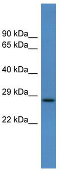 WB Suggested Anti-Caly Antibody Titration: 0.2-1 ug/ml; ELISA Titer: 1: 312500; Positive Control: Rat Lung