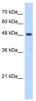 WB Suggested Anti-ERGIC3 Antibody Titration: 0.2-1 ug/ml; Positive Control: HepG2 cell lysate.ERGIC3 is supported by BioGPS gene expression data to be expressed in HepG2