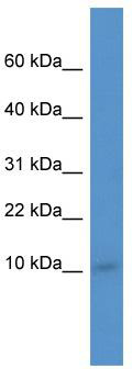 WB Suggested Anti-Ier3ip1 Antibody Titration: 0.2-1 ug/ml; ELISA Titer: 1: 62500; Positive Control: Mouse Kidney