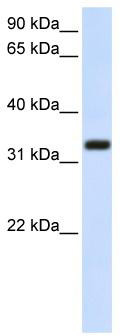 WB Suggested Anti-TMEM66 Antibody Titration: 0.2-1 ug/ml; ELISA Titer: 1: 62500; Positive Control: Transfected 293T