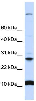 WB Suggested Anti-C19orf56 Antibody Titration: 0.2-1 ug/ml; ELISA Titer: 1: 312500; Positive Control: 721_B cell lysate.WDR83OS is supported by BioGPS gene expression data to be expressed in 721_B