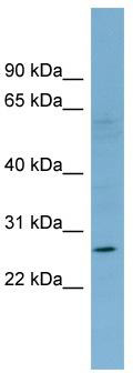 WB Suggested Anti-KLRF1 Antibody Titration: 0.2-1 ug/ml; Positive Control: COLO205 cell lysate