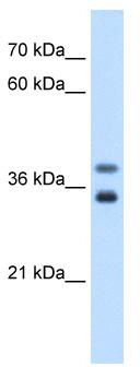 WB Suggested Anti-GDE1 Antibody Titration: 0.2-1 ug/ml; Positive Control: Jurkat cell lysate