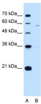 WB Suggested Anti-PIGV Antibody Titration: 5.0 ug/ml; Positive Control: Jurkat cell lysate