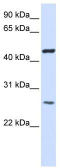 WB Suggested Anti-TMEM127 Antibody Titration: 0.2-1 ug/ml; ELISA Titer: 1: 312500; Positive Control: Transfected 293T
