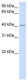 WB Suggested Anti-C2orf18 Antibody Titration: 0.2-1 ug/ml; ELISA Titer: 1: 1562500; Positive Control: Human Lung