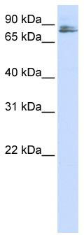 WB Suggested Anti-TMCO3 Antibody Titration: 0.2-1 ug/ml; ELISA Titer: 1: 62500; Positive Control: Hela cell lysate