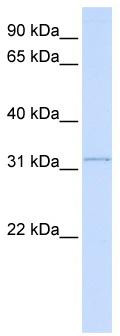 WB Suggested Anti-SUSD4 Antibody Titration: 0.2-1 ug/ml; ELISA Titer: 1: 12500; Positive Control: Human Lung