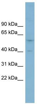 WB Suggested Anti-SUSD4 Antibody Titration: 0.2-1 ug/ml; ELISA Titer: 1: 1562500; Positive Control: PANC1 cell lysate
