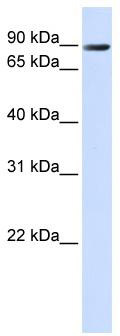 WB Suggested Anti-TMEM16K Antibody Titration: 0.2-1 ug/ml; ELISA Titer: 1: 62500; Positive Control: 293T cell lysate