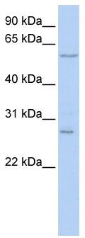 Gel: 12%SDS-PAGE<br>Lysate: 40 μg<br>Lane 1-2: Mouse brain tissue and Human fetal brain tissue<br>Primary antibody: TA371797 (GNAI2 Antibody) at dilution 1/400<br>Secondary antibody: Goat anti rabbit IgG at 1/8000 dilution<br>Exposure time: 10 seconds