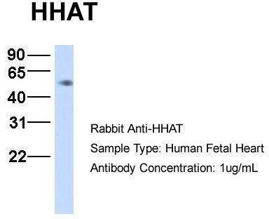 Host: Rabbit; Target Name: HHAT; Sample Tissue: Human Fetal Heart; Antibody Dilution: 1.0 ug/ml