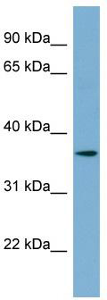 WB Suggested Anti-C1orf75 Antibody Titration: 0.2-1 ug/ml; Positive Control: Human Stomach