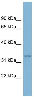 WB Suggested Anti-DBX2 Antibody Titration: 0.2-1 ug/ml; ELISA Titer: 1: 312500; Positive Control: HT1080 cell lysate