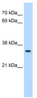 WB Suggested Anti-DBX2 Antibody Titration: 0.2-1 ug/ml; Positive Control: HepG2 cell lysate