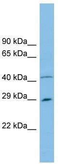 WB Suggested Anti-C9orf152 Antibody Titration: 0.2-1 ug/ml; ELISA Titer: 1: 12500; Positive Control: THP-1 cell lysate