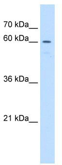WB Suggested Anti-UNCX Antibody Titration: 1 ug/ml; Positive Control: Jurkat cell lysate