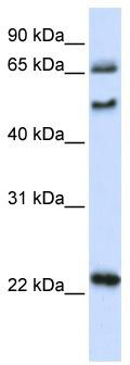 WB Suggested Anti-UNCX Antibody Titration: 0.2-1 ug/ml; ELISA Titer: 1: 312500; Positive Control: 293T cell lysate