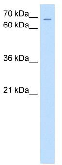 WB Suggested Anti-ZNF131 Antibody Titration: 0.2-1 ug/ml; Positive Control: Jurkat cell lysate.ZNF131 is strongly supported by BioGPS gene expression data to be expressed in Human Jurkat cells