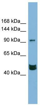 WB Suggested Anti-MAML3 Antibody Titration: 0.2-1 ug/ml; Positive Control: PANC1 cell lysate
