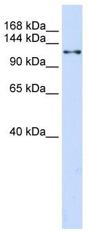 WB Suggested Anti-XPO5 Antibody Titration: 0.2-1 ug/ml; ELISA Titer: 1: 312500; Positive Control: 293T cell lysate