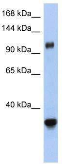 WB Suggested Anti-XPO5 Antibody Titration: 0.2-1 ug/ml; ELISA Titer: 1: 62500; Positive Control: Human Small Intestine